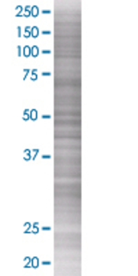 AQP7 transfected lysate.