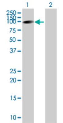 Lane 1: L3MBTL transfected lysate (85.03 KDa) Lane 2: Non-transfected lysate.