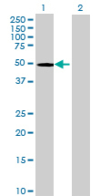 Lane 1: CFH transfected lysate (49.5 KDa) Lane 2: Non-transfected lysate.