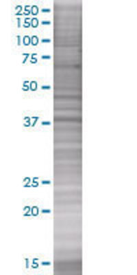 SAE1 transfected lysate
