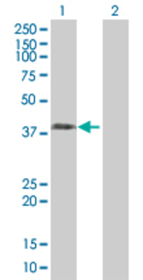 Lane 1: SAE1 transfected lysate (38.4 KDa). Lane 2: Non-transfected lysate.