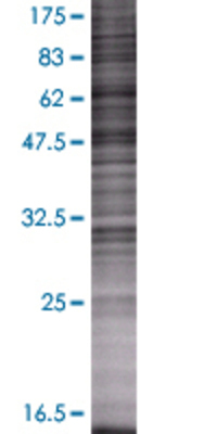 SFTPB transfected lysate.