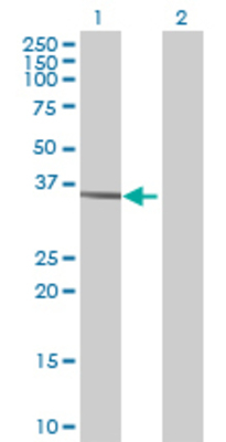 Lane 1: SFTPB transfected lysate (42.02 KDa) Lane 2: Non-transfected lysate.