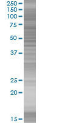 FEV transfected lysate.