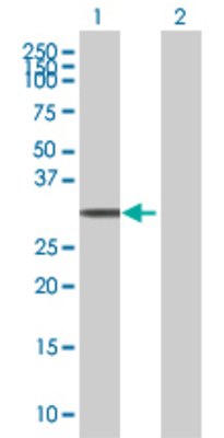 Lane 1: FEV transfected lysate (25 KDa) Lane 2: Non-transfected lysate.