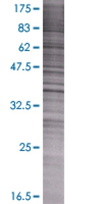 FAM50A transfected lysate.