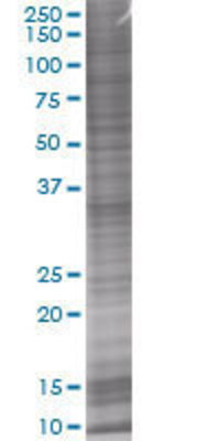 PSME3 transfected lysate