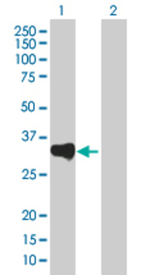 Lane 1: PSME3 transfected lysate (28.05 KDa). Lane 2: Non-transfected lysate.