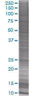 ULK3 transfected lysate