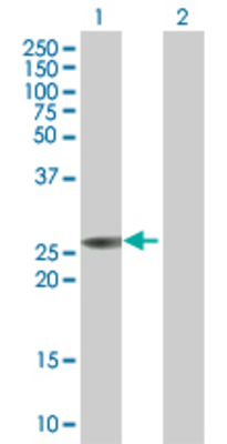 Lane 1: ULK3 transfected lysate (23.65 KDa). Lane 2: Non-transfected lysate.
