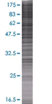 PTGDS transfected lysate.