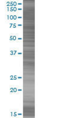 PSAT1 transfected lysate.