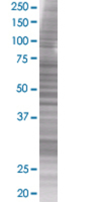 PSMB8 transfected lysate.
