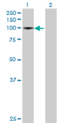 Lane 1: CTNNA2 transfected lysate (99.66 KDa) Lane 2: Non-transfected lysate.