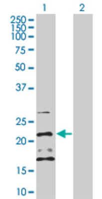 Lane 1: IFNG transfected lysate (19.3 KDa). Lane 2: Non-transfected lysate.