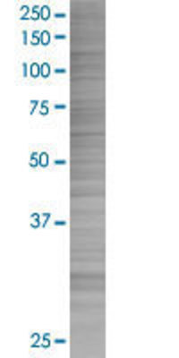 TFF2 transfected lysate.