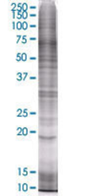 CDKN2D transfected lysate