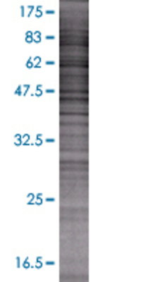 LIPA transfected lysate.