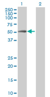 Lane 1: LIPA transfected lysate (44 KDa) Lane 2: Non-transfected lysate.