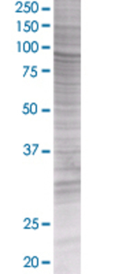 MST1 transfected lysate.