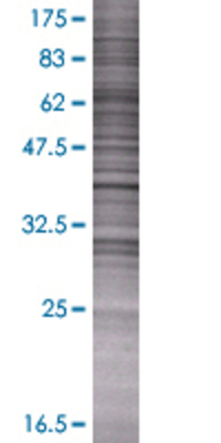 HPS3 transfected lysate.