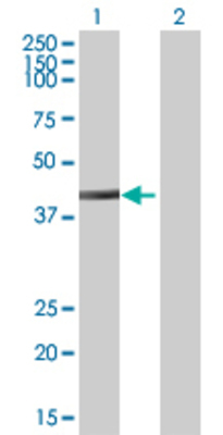 Lane 1: HPS3 transfected lysate (41.03 KDa) Lane 2: Non-transfected lysate.