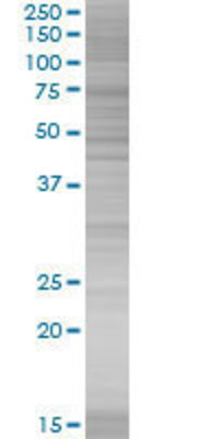 NEUROD2 transfected lysate.
