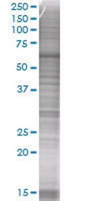 NOL4 transfected lysate.