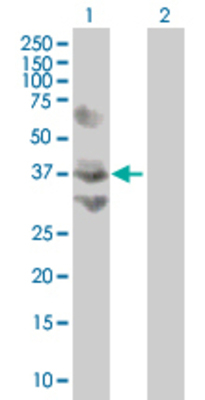 Lane 1: NOL4 transfected lysate (46.42 KDa) Lane 2: Non-transfected lysate.
