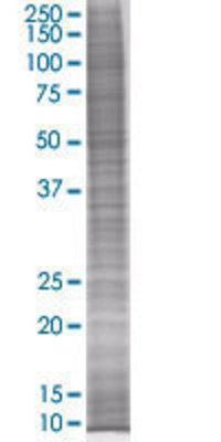 PPP2R3B transfected lysate