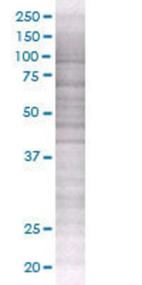 TNFRSF10C transfected lysate.