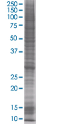 PSME1 transfected lysate