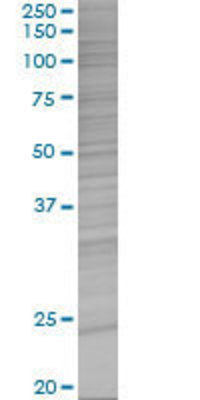 GUK1 transfected lysate.
