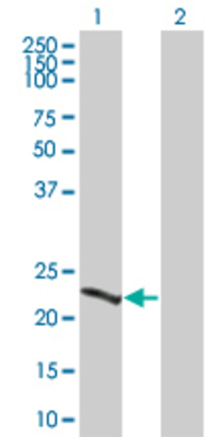 Lane 1: GUK1 transfected lysate (21.78 KDa) Lane 2: Non-transfected lysate.