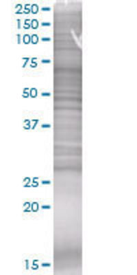 MRPL40 transfected lysate