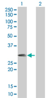 Lane 1: MRPL40 transfected lysate (22.77 KDa). Lane 2: Non-transfected lysate.
