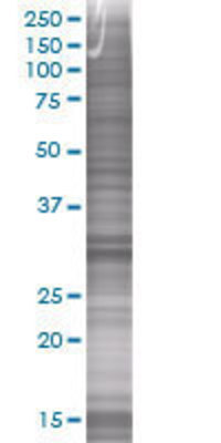 CHMP2A transfected lysate.