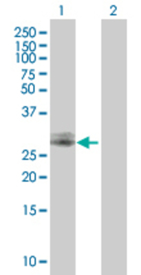 Lane 1: CHMP2A transfected lysate (24.42 KDa) Lane 2: Non-transfected lysate.
