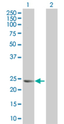 Lane 1: MYL6B transfected lysate (22.8 KDa) Lane 2: Non-transfected lysate.