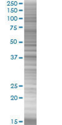 PPP2R4 transfected lysate.