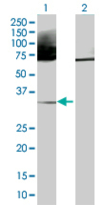 Lane 1: HLA-DRB3 transfected lysate (30 KDa). Lane 2: Non-transfected lysate.