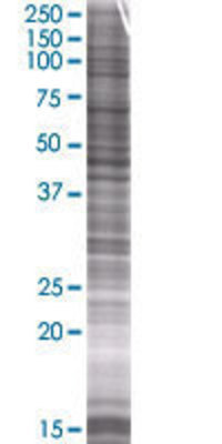 DFNA5 transfected lysate.