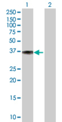 Lane 1: DFNA5 transfected lysate (32.56 KDa) Lane 2: Non-transfected lysate.