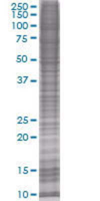CIDEC transfected lysate