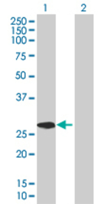 Lane 1: CIDEC transfected lysate (26.29 KDa). Lane 2: Non-transfected lysate.