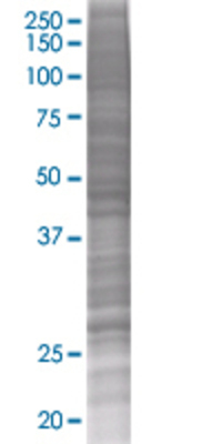 YWHAZ transfected lysate