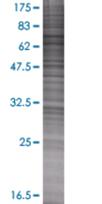 POLR3C transfected lysate.
