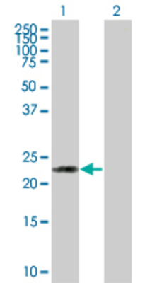 Lane 1: HSPC111 transfected lysate (21.2 KDa) Lane 2: Non-transfected lysate.
