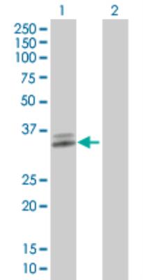 Western Blot: ATPase Na+/K+ beta 3 Overexpression Lysate (Denatured) [H00000483-T01] - Lane 1: ATP1B3 transfected lysate (31.5 KDa). Lane 2: Non-transfected lysate.