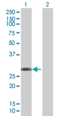 Lane 1: FGF21 transfected lysate (22.3 KDa). Lane 2: Non-transfected lysate.